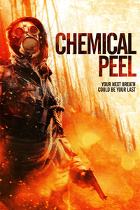 Chemical Peel